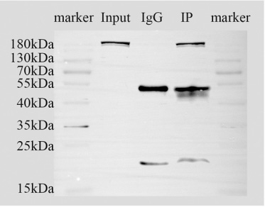 免疫共沉淀（CO-IP)